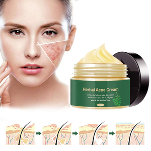 Krim Perawatan Bekas Jerawat <span class=keywords><strong>Herbal</strong></span> Organik Terbaik Label Pribadi - Product Image 5