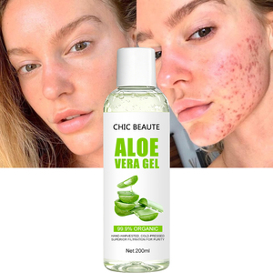 CHIC BEAUTE Marque Privée 99% <span class=keywords><strong>Pur</strong></span> Naturel Biologique Extrait d'Aloès Gel <span class=keywords><strong>Crème</strong></span> Apaisant et Réparateur Après-Soleil Doux à l'Aloès Vera pour le Visage - Product Image 1