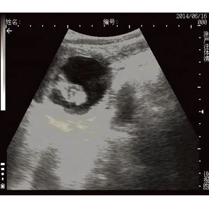 Alat USG Sapi Sektor Mekanik Digital Penuh KX-5100 Murah - Product Image 5