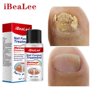 IBeaLee 20ml soluzione per la riparazione delle unghie clean whiten nourish nails trattamento fungino trattamento dei funghi delle unghie dei piedi - Product Image 1