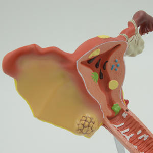 מודל הרחם פתולוגי (2-קטע)-הפאת הפתולוגיה הנשית - Product Image 2