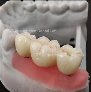 Puente de Zirconia para dentaduras postizas de implante adecuado para la mayoría de los postes de escaneo del sistema de implante se pueden proporcionar <span class=keywords><strong>Freey</strong></span> - Product Image 3