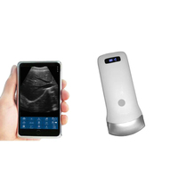 Sonde échographique convexe B portable sans fil Sonostar – Échographe sans fil