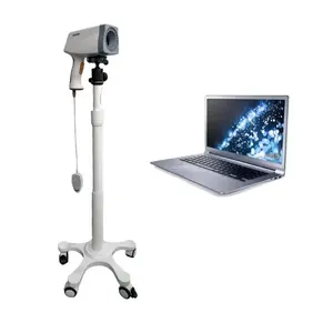 Kernel colposcope kn2200 Prime HD LED Gynaecology video digital colposcope for vagina 0.8MP CCD work station powerful software