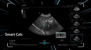 Système d'échographie diagnostique vétérinaire Mindray Vetus 50 pour chats et chiens avec système d'imagerie diagnostique et Doppler couleur - Product Image 5