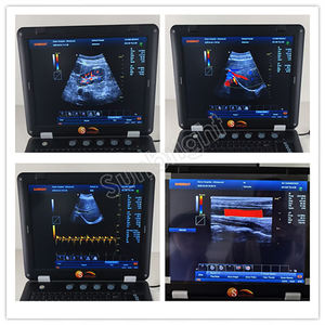 Peralatan dokter hewan 192 elemen Ultrasound Laptop 3D 4D Ultrasound pemindai suara mesin Ultrasound - Product Image 6