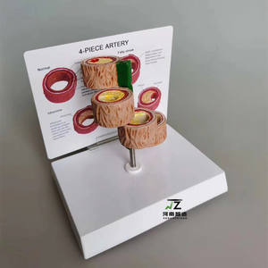 แบบจำลองการสาธิตลิ่มเลือดอุดตันในหลอดเลือดแดงของมนุษย์ 4 ชิ้น สำหรับการศึกษาทางวิทยาศาสตร์การแพทย์ แบบจำลองโรคในมนุษย์ - Product Image 5