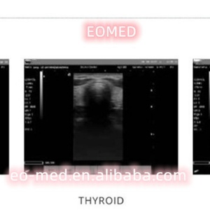 Système d'échographie diagnostique noir et blanc pour hôpitaux, usage humain, obstétrique et gynécologie, transducteur ultrasonore BW21B - Product Image 5