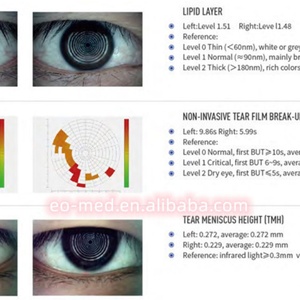 Analizador de Examen Completo para Ojo Seco, Análisis de Hiperemia Conjuntival, Equipo Oftalmológico DEA60 - Product Image 6
