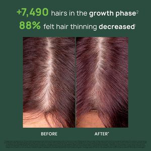 Rene <span class=keywords><strong>Furterer</strong></span> R16 Tripha, 8 X 5.5 ml - Product Image 3