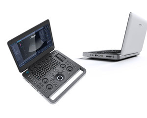 Sonoscape X5V para Mascotas, Ecógrafo Doppler Color Digital Portátil, Ligero, con Pantalla de 15.6 Pulgadas, Precio de Fábrica - Product Image 2