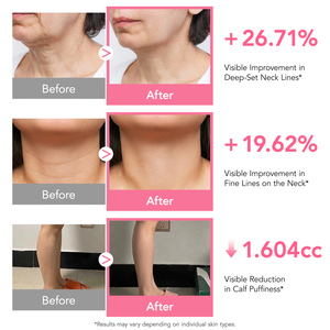 마사이지 콜라겐 구아샤 크림 내장 마사지기 볼루필린 5% 탄력 피부 미백 PDRN 콜라겐 구아샤 목 주름 크림 - Product Image 6