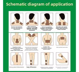 肩部ヘルスケア指値圧力刺激パッチ-頸部および肩部関節炎疼痛緩和パッチ - Product Image 5