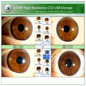 5MP English Iris <span class=keywords><strong>Analyzer</strong></span> Eye iriscope iridology <span class=keywords><strong>Camera</strong></span> Pro phần mềm được thiết kế để phân tích cơ thể toàn diện - Product Image 4