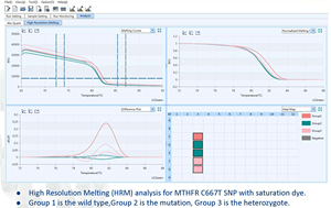 <span class=keywords><strong>Test</strong></span> de <span class=keywords><strong>paternité</strong></span> <span class=keywords><strong>ADN</strong></span> Gentier 96E PCR quantitative automatique en temps réel - Product Image 5