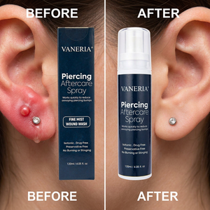 Spray de Soin Post-<span class=keywords><strong>Piercing</strong></span> Marque Blanche OEM, Spray Salin pour Blessures, Élimination des Protubérances de <span class=keywords><strong>Piercing</strong></span>, Brume Apaisante Nettoyante pour Oreilles 120ml - Product Image 1