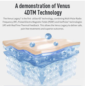 4D Multi-Polar Body Venus Legacy Cellulite Massage for Lymphatic Drainage 4 Handles Body Shape Slim Machine - Product Image 5