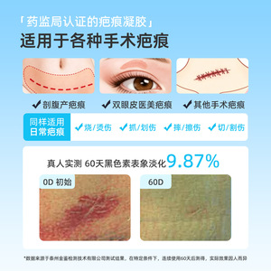 Gel cicatrisant au collagène recombinant de type III humanisé Haishi Hainuo 1,0 mg/g pour l'amélioration des cicatrices après la cicatrisation des plaies - Product Image 4
