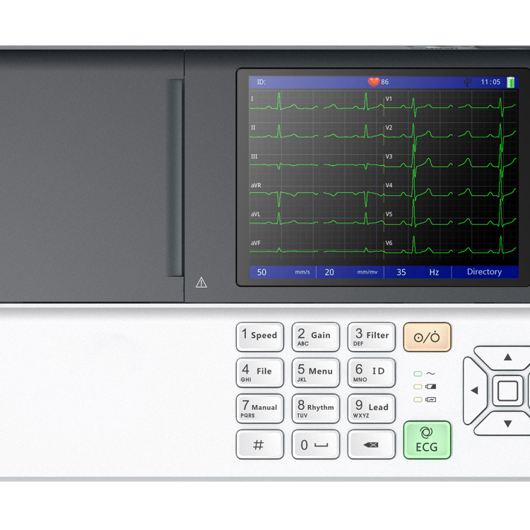 Electrocardiograma digital portátil plegable de 5.6 pulgadas con aspiración digital de 3 canales