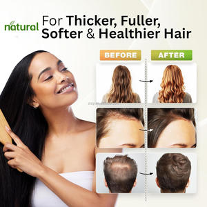 Huile Essentielle de Romarin 100% Biologique, Végane, à Base de Plantes, pour une Croissance Rapide des Cheveux, Soin Nourrissant du Cuir Chevelu, Sérum pour la Repousse des Cheveux - Product Image 2