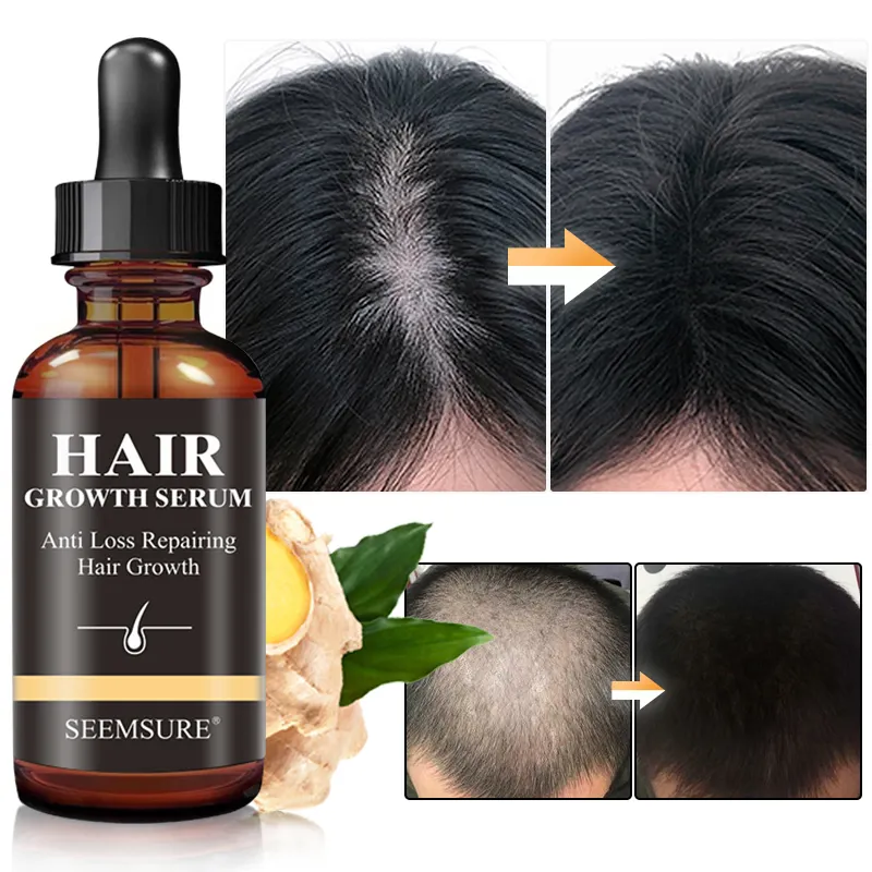 Sérum de curcuma à l'huile de cheveux réparatrice anti-perte, haute efficacité, marque privée, traitement pour cheveux chauves, gingembre, croissance des cheveux