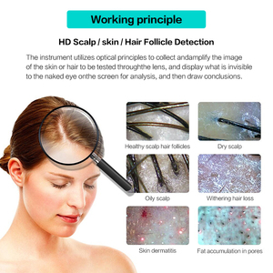 Lufenbeauty Intelligent Detection Beauty Salon Use Handheld Hair Scalp Analyzer Machine Hair Analyser - Product Image 4