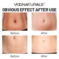 Le masque de ventre sans danger pour la grossesse hydrate et répare les vergetures Masque de ventre naturellement naturel pour les vergetures