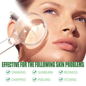 Cuidado DE LA PIEL Vegan After Sun Care con Aloe Vera Loción calmante e hidratante para quemaduras solares After Sun Burn - Product Image 3