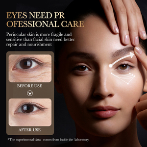 The Most Popular SADOER <strong>Snake</strong> <strong>Venom</strong> Peptide Multi-Effect Moisturizing <strong>Eye</strong> <strong>Cream</strong> for Improving Dark Circles - Product Image 3