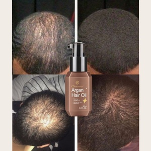 Aceite de Argán para el Cabello de Bajo Pedido Mínimo, Previene y Repara, Protege del Daño por Calor, Previene la Rotura y las Puntas Abiertas - Product Image 5