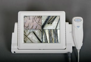 Analizador Portátil de Piel y Cabello con Pantalla LCD de 8 Pulgadas, Aumento de 50-200x, Operación Sencilla, Dermatoscopio con Video, Dispositivo de Belleza Chino - Product Image 2