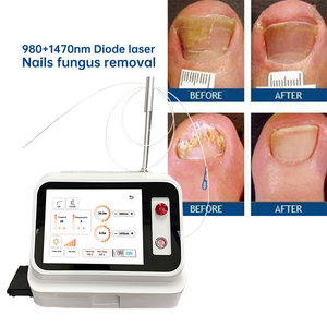 <span class=keywords><strong>Tratamiento</strong></span> Eficaz para Onicomicosis, <span class=keywords><strong>Hongos</strong></span> en las <span class=keywords><strong>Uñas</strong></span>, <span class=keywords><strong>Tratamiento</strong></span> para <span class=keywords><strong>Hongos</strong></span> en las <span class=keywords><strong>Uñas</strong></span> y Pies, Fisioterapia - Product Image 6