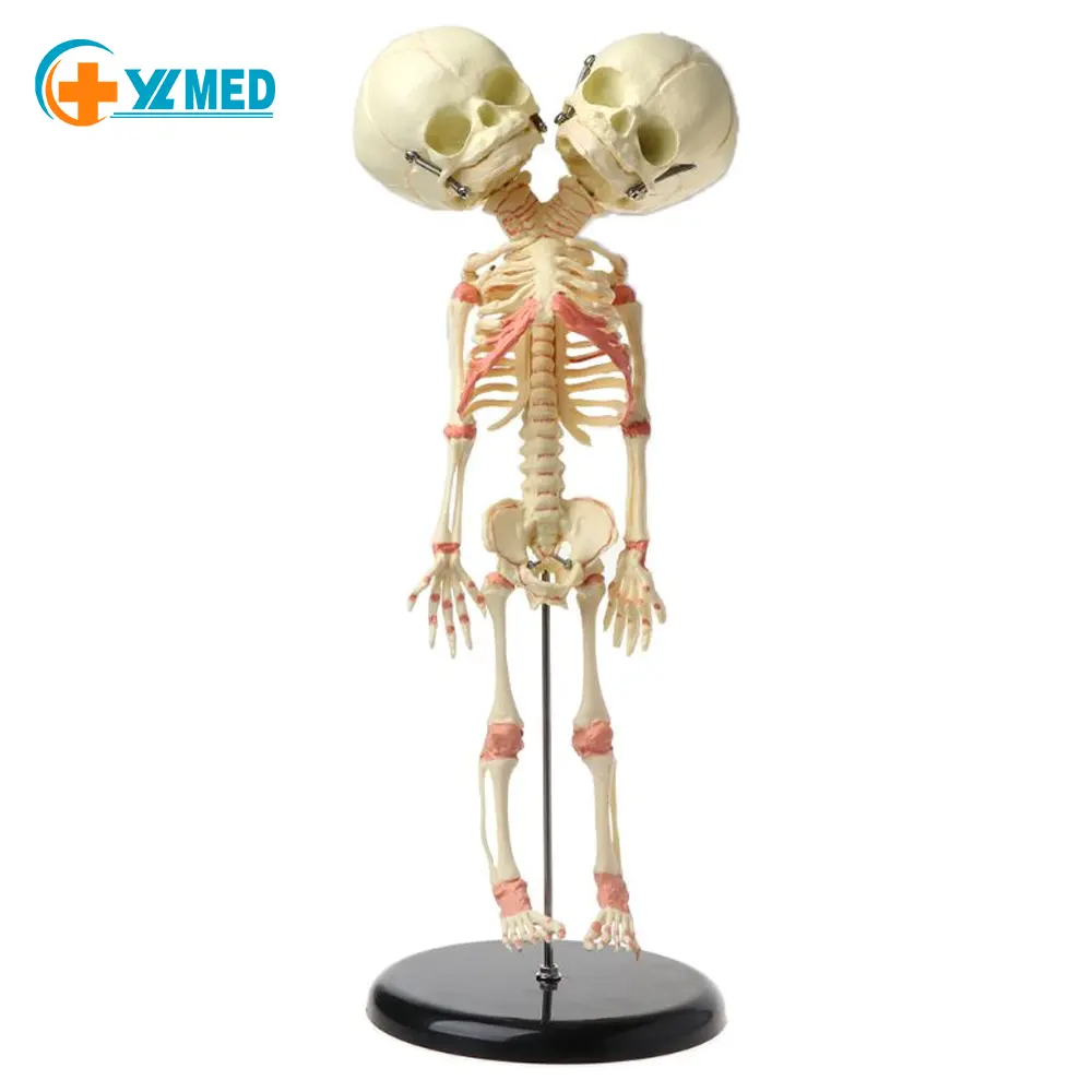 37Cm Science Teaching Display Tweekoppige Baby Skeletmodel Gemaakt Van Pvc-Materiaal Voor Medicijnen