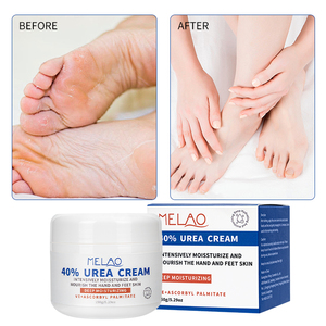 Crème Réparatrice Pieds Peaux Sèches Marque Blanche Hydratante Adoucissante Anti-Callosités aux Herbes 40% Urée Lotion Mains <span class=keywords><strong>Antifongique</strong></span> Soin de la Peau - Product Image 2
