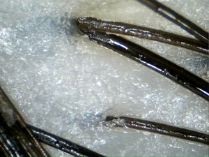 Novidade analisador de couro cabeludo tudo em um analisador de pele e cabelo - Product Image 6