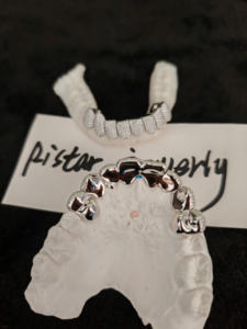 <span class=keywords><strong>Grillz</strong></span> Dents en Moissanite et Diamant VVS Sertis Nid d'Abeille, Joaillerie Fine Hip Hop Argent 925 Plaqué Or Véritable sur Mesure - Product Image 4