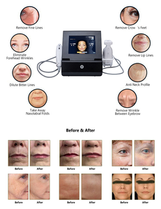 Appareil portable d'échographie focalisée 2 en 1 HIFU pour le rajeunissement de la peau, machine liposonique pour le raffermissement et l'amincissement de la peau - Product Image 6