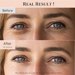 Sérum pour <span class=keywords><strong>les</strong></span> <span class=keywords><strong>yeux</strong></span> coréen avancé 30ml Ginseng Collagène Squalane Traitement de réparation anti-âge intensif Effacement des rides Restaurer la jeunesse - Product Image 6