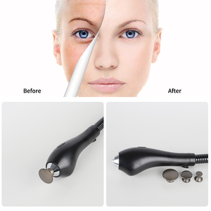 Manípulo profesional de microagujas RF con refrigeración por <span class=keywords><strong>hielo</strong></span>, piezas de equipo láser para tensado de piel, accesorio para máquina de belleza - Product Image 6
