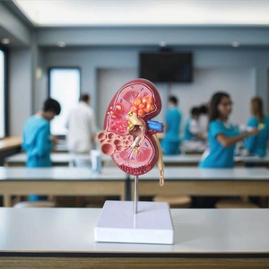 Medisch Wetenschappelijk Product Pathologisch Anatomiemodel Van Niercyste Nierziekte Model Menselijk Anatomiemodel - Product Image 3