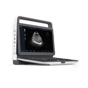 Aparelho portátil de ultrassom 5d - Product Image 5