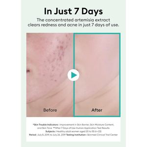 มิชชา อาร์เทมิเซีย คาล์มมิ่ง แอมพูล 50 มล. เซรั่มบำรุงผิวหน้า สำหรับผิวแพ้ง่าย ผลิตภัณฑ์บำรุงผิวจากเกาหลี - Product Image 2