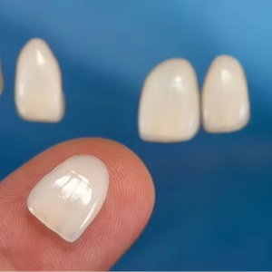 Yucera <span class=keywords><strong>Dental</strong></span> Impress Cerámica Lingotes Dentadura Odontología Vidrio <span class=keywords><strong>Dental</strong></span> Cad Cam Odontología - Product Image 2
