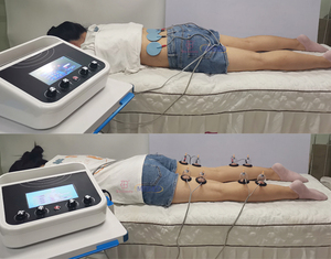 Almohadilla de electrodos Alivio del dolor <span class=keywords><strong>muscular</strong></span> eléctrico Smart Ems Estimulador <span class=keywords><strong>muscular</strong></span> Tens Máquina de electroestimulación - Product Image 6