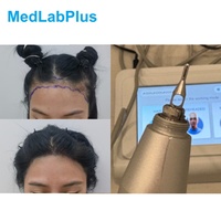 Mesin Transplantasi Rambut FUE, Peralatan Transplantasi Rambut, Punch FUE Rambut Panjang