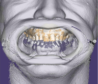 Nuevo escáner 3D Facial Thunk3D para implante de arco completo odontología Digital Facebow Digital artilulador Virtual