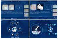 Appareil d'exfoliation microcristalline pour le visage, technologie intelligente de glace bleue pour le nettoyage de la peau et le traitement de l'acné
