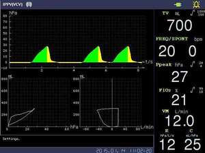 جهاز تخدير عالي الجودة من معدات التخدير الطبية والملحقات - Product Image 6