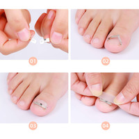 Kit de soins des pieds classique portable en acier inoxydable pour la correction des ongles incarnés, avec orthèse à rainure pour ongles et patch de correction, pour pédicure