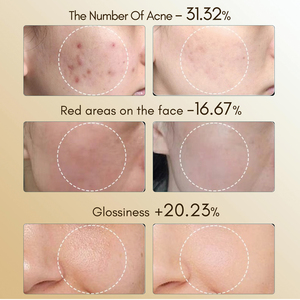 7 màu Photon Mặt nạ trị liệu 630nm 850nm <span class=keywords><strong>LED</strong></span> Mặt nạ Collagen Boost xách tay USB-C nhãn trắng - Product Image 4